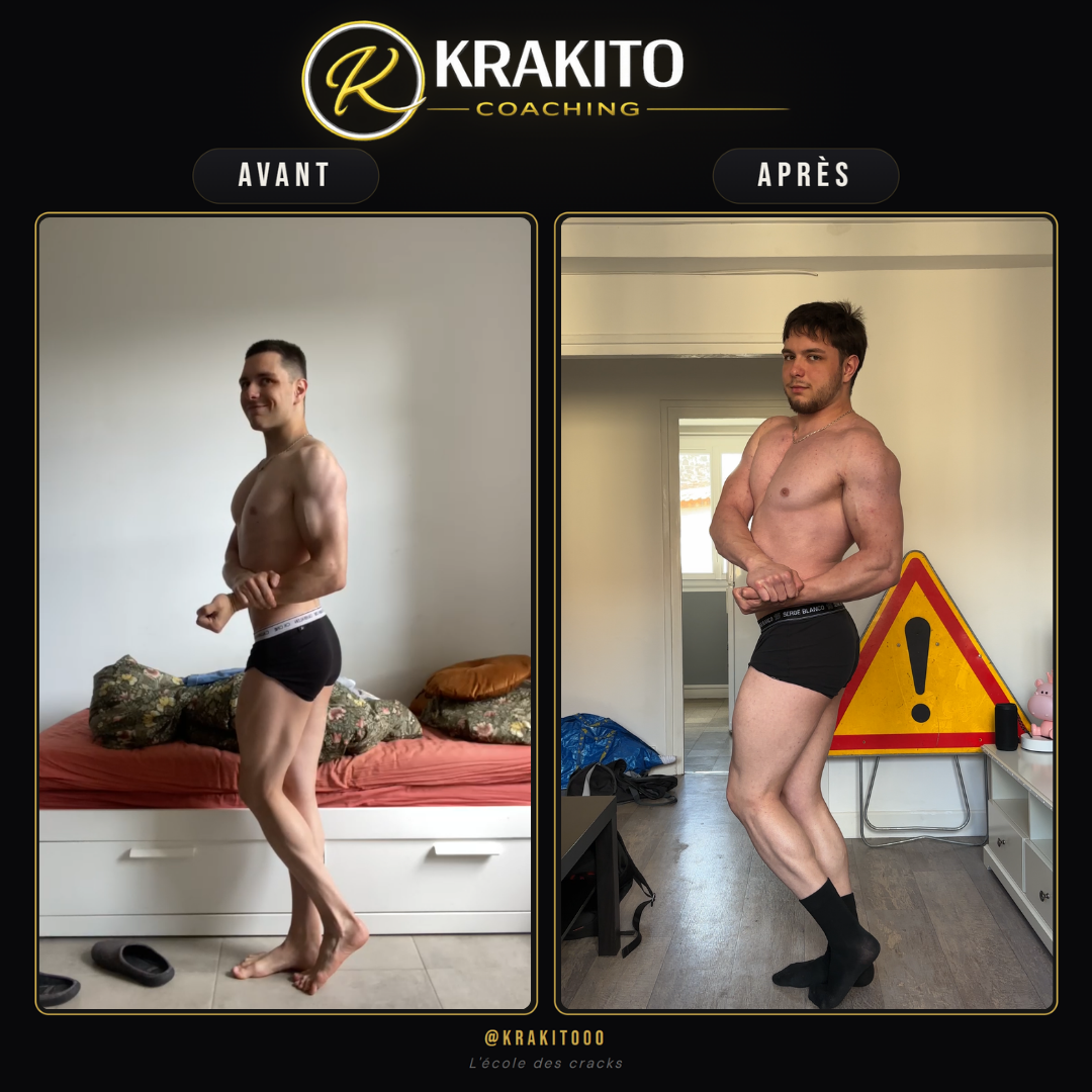 Avant / après de Mattéo, profil